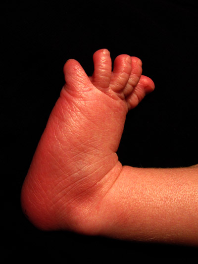 infant baby foot